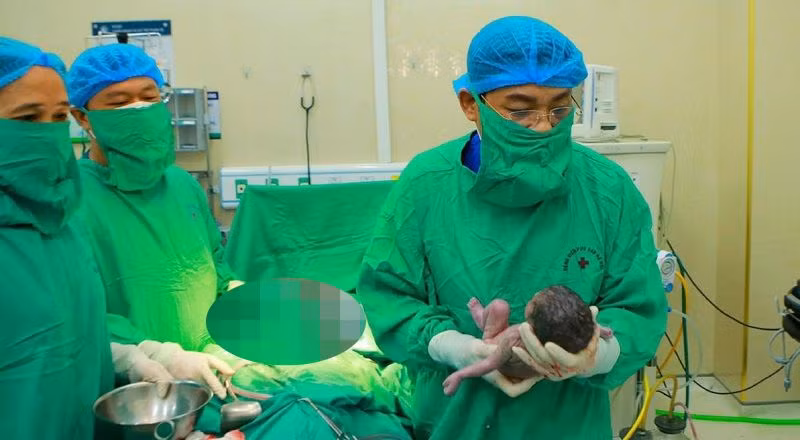 Giáo sư, Tiến sĩ Nguyễn Duy Ánh - Giám đốc Bệnh viện Phụ sản Hà Nội mổ lấy thai cho sản phụ. 