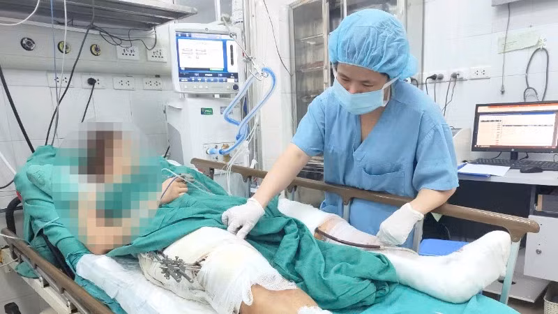 Bệnh nhân Nguyễn Thị N. (32 tuổi; Gia Lộc, Hải Dương) chẩn đoán đa chấn thương, đang được chăm sóc tại khoa Hồi tỉnh 3, Trung tâm Gây mê và Hồi sức Ngoại khoa. 
