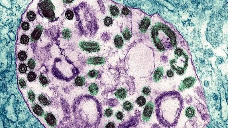Hình ảnh dưới kính hiển vi điện tử của virus Marburg. (Ảnh: BSIP/UIG/Getty Images)