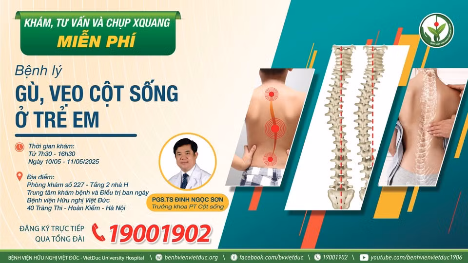 Thông tin khám và tư vấn miễn phí cho trẻ em mắc gù vẹo cột sống ở Bệnh viện Hữu Nghị Việt Đức. Thông tin khám và tư vấn miễn phí cho trẻ em mắc gù vẹo cột sống ở Bệnh viện Hữu Nghị Việt Đức.