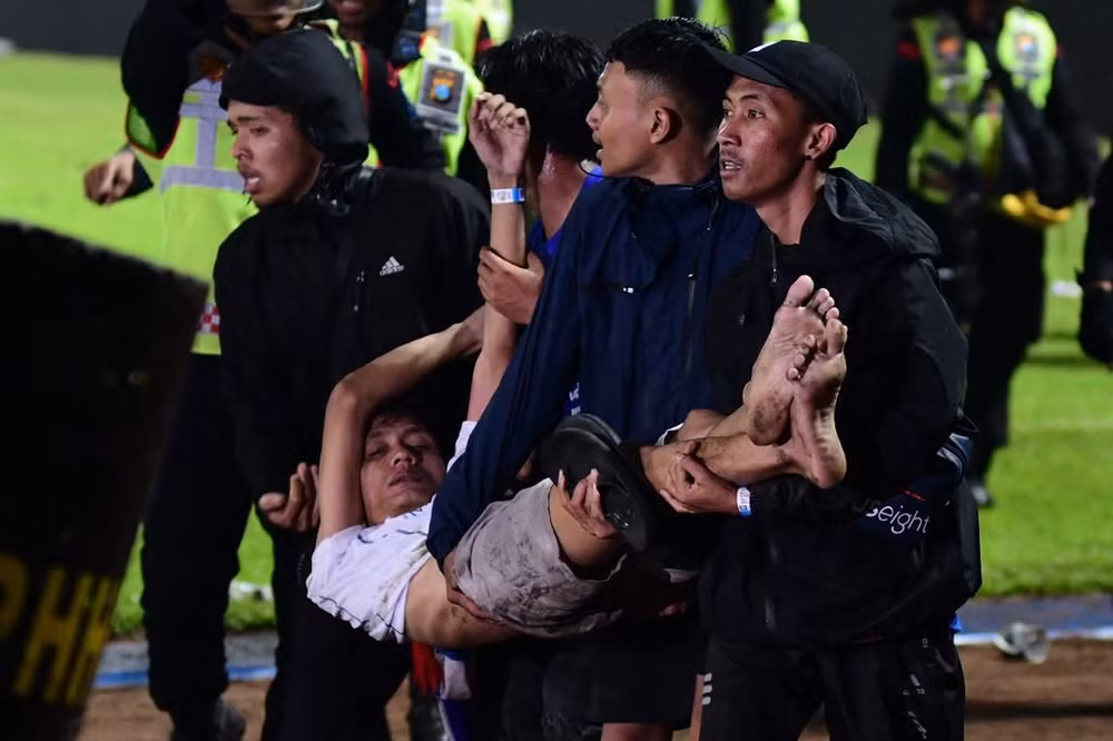Một nạn nhân trong vụ bạo động tại sân vận động Kanjuruhan. (Ảnh: Jakarta Post)