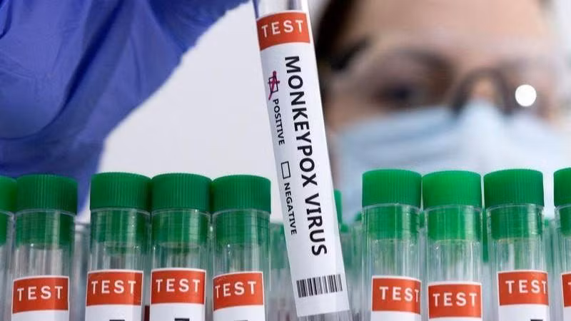Ống đựng mẫu xét nghiệm dương tính với đậu mùa khỉ. (Ảnh: Reuters)