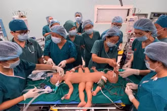 (Ảnh: Bệnh viện Nhi đồng thành phố)