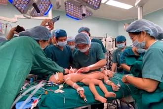 Các bác sĩ bắt đầu cuộc mổ tách dính cặp song sinh Trúc Nhi - Diệu Nhi. 