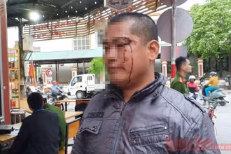 Anh Triệu La Luyện bị đánh gây thương tích, chảy máu vùng mặt.