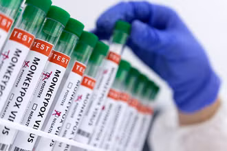 Ống đựng mẫu bệnh phẩm có đánh dấu dương tính với virus gây đậu mùa khỉ. (Ảnh: Reuters)