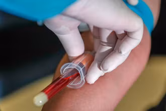 Phát hiện mới này củng cố hy vọng về vaccine Covid-19. Ảnh: EPA.
