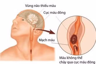 (Ảnh minh họa)