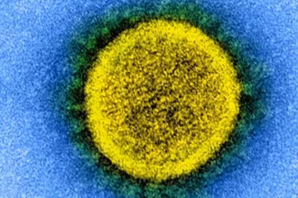 Sự lây truyền của virus SARS-CoV-2. Ảnh: NIH.