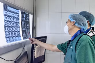 Các bác sĩ khoa Chẩn đoán hình ảnh hội chẩn trước can thiệp cho bệnh nhân.