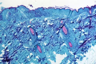 Hình ảnh một phần mô, được lấy từ vết thương trên da của 1 con khỉ nhiễm virus đậu mùa khỉ, được phóng đại 50X vào năm 1968. (Ảnh: REUTERS) 