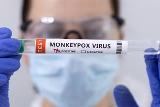 Ống đựng mẫu bệnh phẩm được đánh dấu dương tính với virus gây bệnh đậu mùa khỉ. (Ảnh: Reuters)