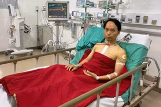 Hiện tại, bệnh nhân H đã tự thở, các chỉ số huyết động và sinh hóa ổn định, chức năng tim tốt.