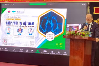 PGS, TS Nguyễn Viết Nhung phát biểu khai mạc. 