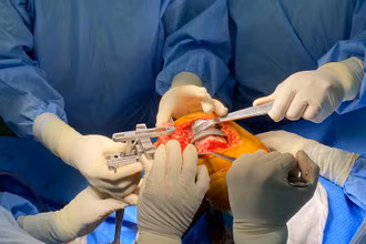 Ê kíp bác sĩ Bệnh viện Chợ Rẫy phẫu thuật cho bệnh nhân.