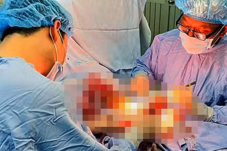Ê-kíp tiến hành phẫu thuật hơn 5 giờ nối lại bàn tay đứt rời cho bệnh nhân.