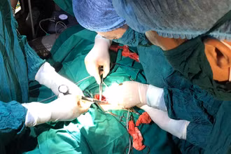 Các bác sĩ TTYT Bạch Long Vĩ mổ cấp cứu cho bệnh nhân Nghĩa.