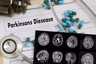 AI có thể giúp theo dõi chính xác từ xa bệnh nhân mắc Parkinson.