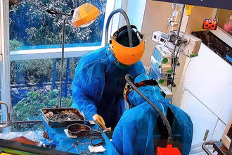 Chín bệnh nhân Covid-19 phải sử dụng phương pháp tim phổi nhân tạo