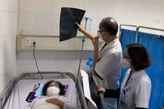 Bệnh nhân đang được chăm sóc đặc biệt sau khi xử lý biến chứng do tiêm filler. 