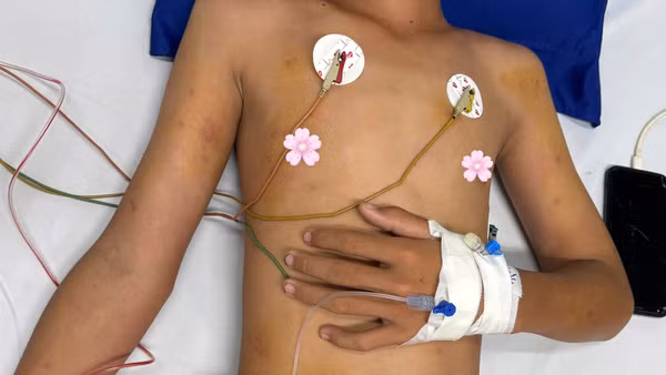 Bệnh nhi H. đã qua cơn nguy kịch và đang được tiếp tục chăm sóc, theo dõi tại Bệnh viện Sản-Nhi Cà Mau. (Ảnh do người nhà bệnh nhi cung cấp).
