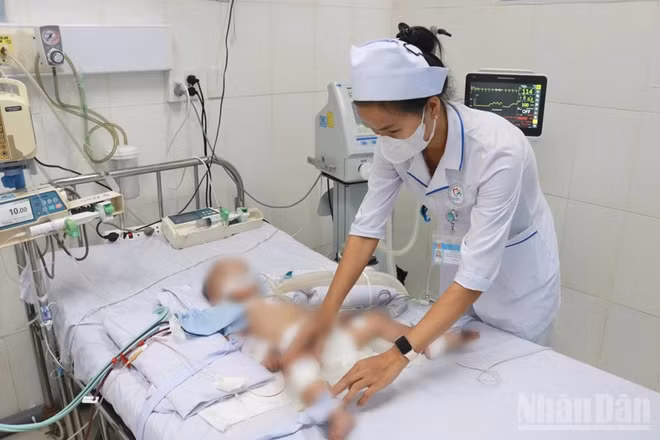 Bệnh nhi Đ.X.Th (16 tháng tuổi, trú xã Phước Hữu, tỉnh Khánh Hòa) nhập viện trong tình trạng bệnh diễn tiến sang tay chân miệng độ 3 với nhiều biểu hiện nguy kịch. (ảnh: NGUYỄN HƯƠNG)