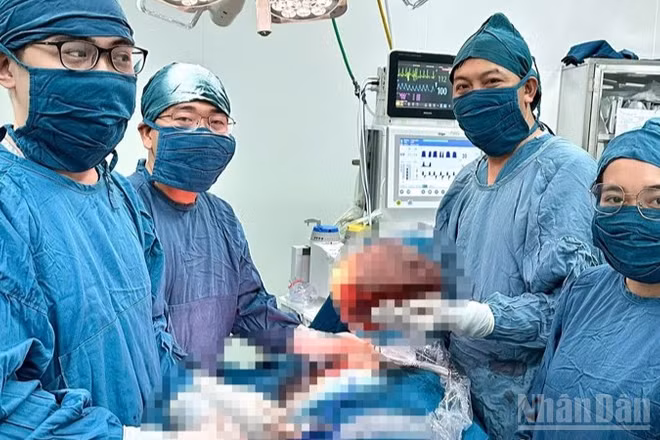 Ê-kíp bác sĩ Khoa Ngoại tổng hợp, Bệnh viện đa khoa Ninh Thuận thực hiện phẫu thuật cho bệnh nhân. (Ảnh: đơn vị cung cấp)