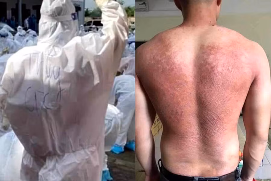 Thứ trưởng Nguyễn Trường Sơn: 
