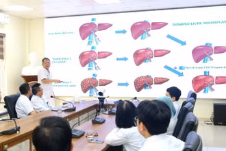 Phó Giáo sư, Tiến sĩ Dương Đức Hùng, Giám đốc Bệnh viện Hữu nghị Việt Đức cùng các bác sĩ hội chẩn trường hợp ghép tạng domino đặc biệt.
