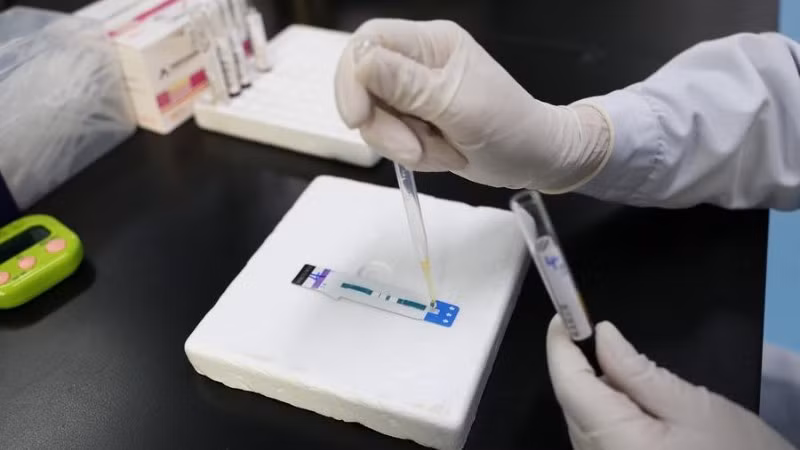 Bác sĩ xét nghiệm mẫu bệnh phẩm để phát hiện HIV/AIDS tại Bệnh viện Nhân dân số 4 Nam Ninh, thành phố Nam Ninh, Khu tự trị dân tộc Choang Quảng Tây, Trung Quốc, ngày 21/11/2024. (Ảnh: Tân Hoa Xã)