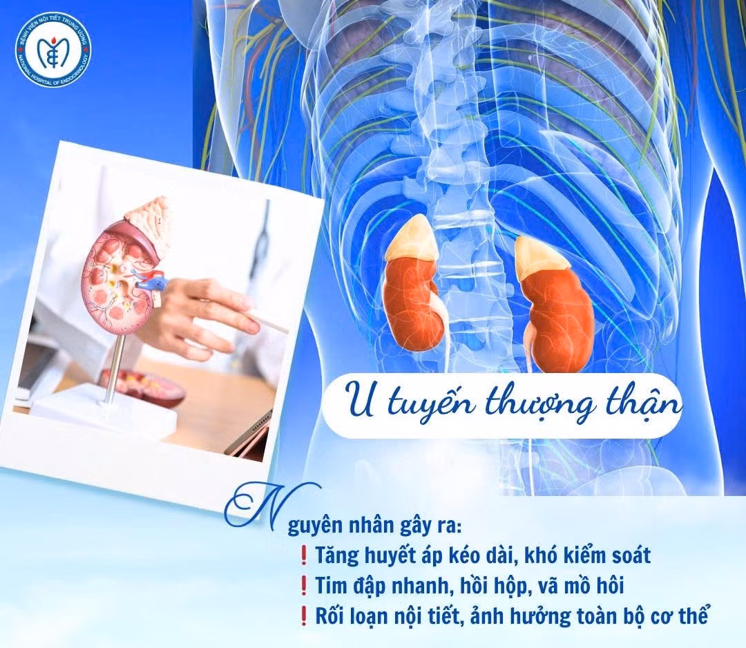 1-u-thuuong.jpg