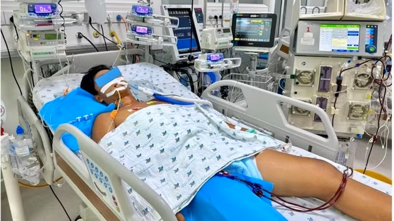 Bệnh nhi điều trị tại Bệnh viện Nhi đồng Thành phố Hồ Chí Minh. (Ảnh: Bệnh viện cung cấp)
