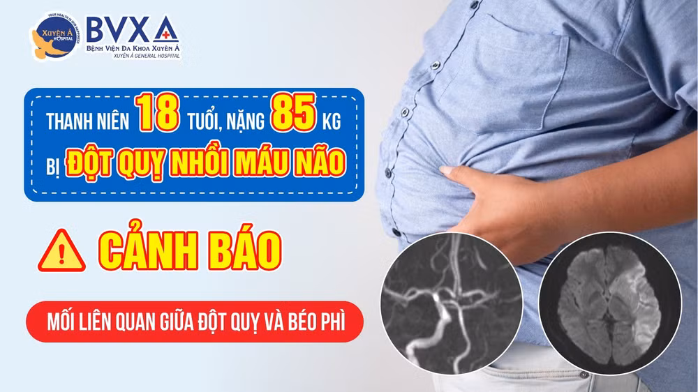 Ảnh minh họa. (Bệnh viện cung cấp)
