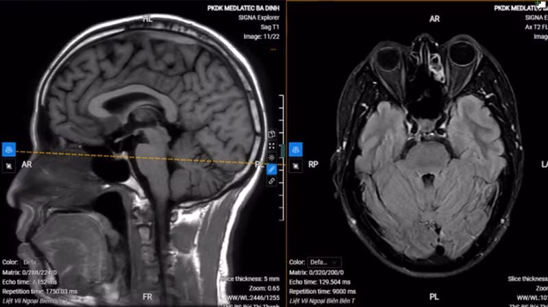 Hình ảnh chụp MRI của bệnh nhân.
