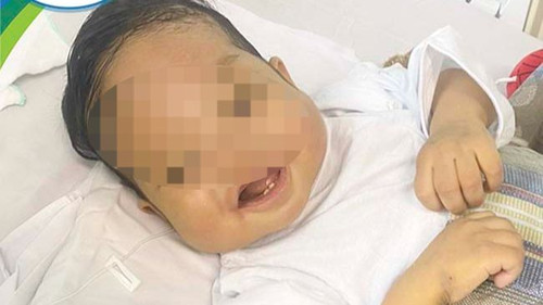 Bé B.A hồi sinh sau ca ghép tạng.