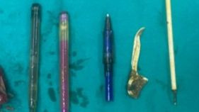 Bệnh phẩm bao gồm: Đoạn đại tràng Sigma và dị vật (bút, ngòi bút và tăm nhựa).