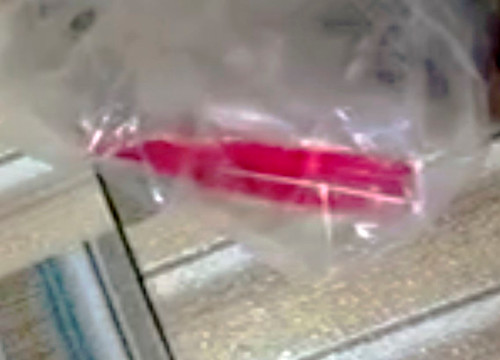 Loại thuốc diệt chuột bệnh nhân đã uống được người nhà cung cấp cho bệnh viện.