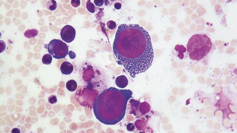 Ghi nhận ca viêm não cấp hiếm gặp do Parvovirus B19 ở Việt Nam Parvovirus B19 tập trung lây nhiễm ở các tế bào phân chia nhanh, gây độc làm cho tế bào chết nhanh và gây viêm xung quanh. (Ảnh minh họa)