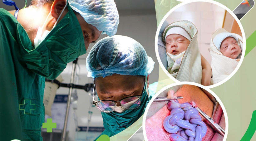 Hai bé gái chào đời ở tuần thai 30 an toàn. 