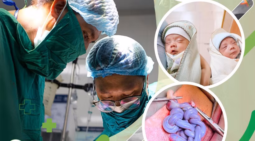 Hai bé gái chào đời ở tuần thai 30 an toàn. 