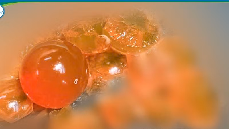 Dị vật được lấy ra là những hạt nhựa nhỏ, có khả năng trương nở khi gặp nước.