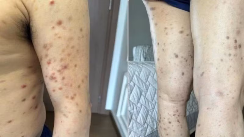 Tổn thương của bệnh nhân. 