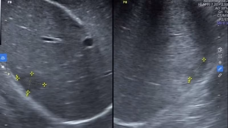 Hình ảnh siêu âm của bệnh nhân. 