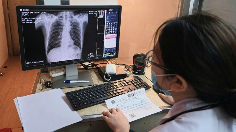 Chụp X-quang phổi sàng lọc bệnh lao. 