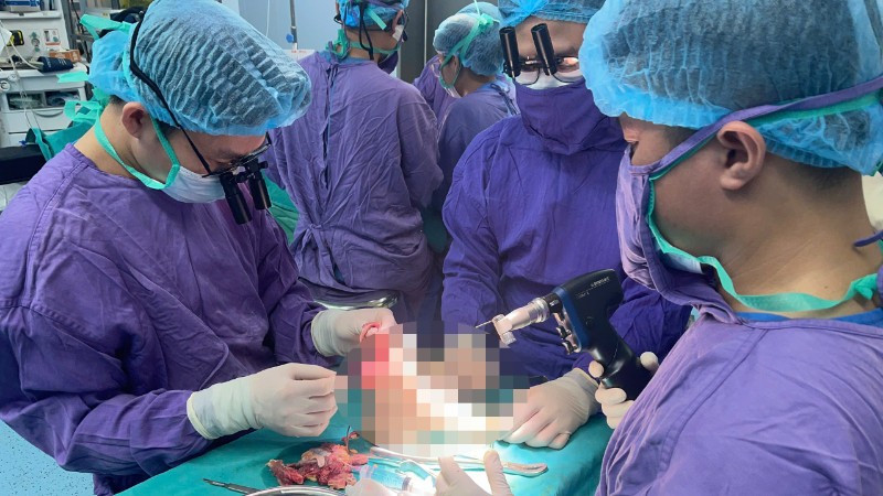 Kíp y, bác sĩ thực hiện ca phẫu thuật xuyên đêm cứu bàn chân cho nữ sinh gặp nạn.