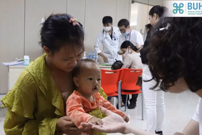 Trẻ em bị dị tật khe hở môi-vòm miệng tham gia chương trình phẫu thuật nụ cười cho trẻ em do Sở Y tế tỉnh Đắk Lắk phối hợp Tổ chức Operation Smile Việt Nam triển khai năm 2023 tại Bệnh viện Đại học Y Dược Buôn Ma Thuột.