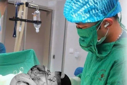 Các bác sĩ Bệnh viện Phụ Sản Hà Nội đã triển khai kịp thời ca cấp cứu, bảo toàn tính mạng mẹ và con.