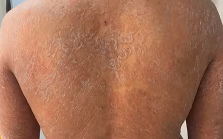 Tình trạng bệnh nhân khi đến khám. 