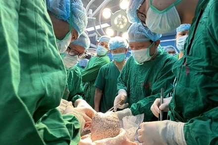 Các thầy thuốc thực hiện ca ghép phổi cuối năm. 