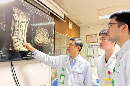 Hình ảnh cộng hưởng từ cho thấy người bệnh bị hẹp ống sống cổ đa tầng (C4-C6).